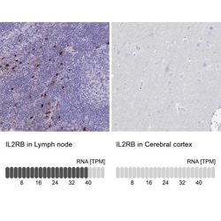 IL-2 R beta Antibody, Novus Biologicals 25 μL, Unlabeled:Antibodies,